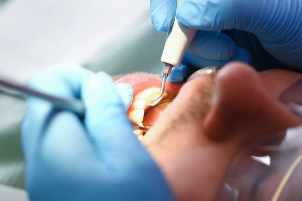 Best Emergency Tooth Extraction in St Paul Park, MN