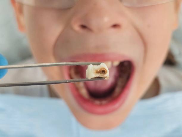 Best Walk-In Emergency Dentist in St Paul Park, MN